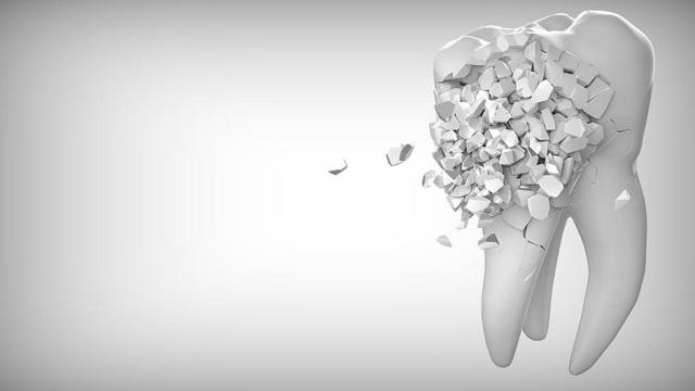 El cierre de iDental ha provocado que la sanidad haya sido el sector más denunciado por los usuarios en 2018 / PIXABAY