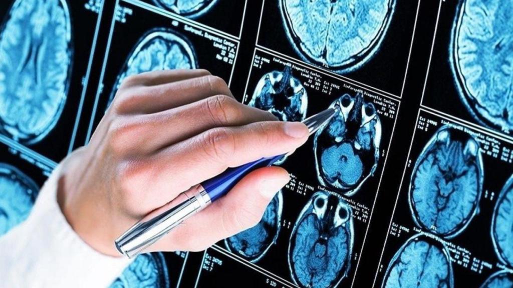 Pruebas de la afectación cerebral de demencia y alzhéimer