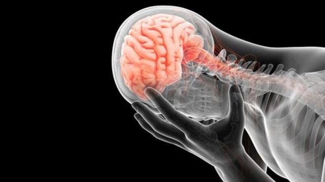 Una persona sufriendo dolo de cabeza, una de los síntomas del ictus / EUROPA PRESS