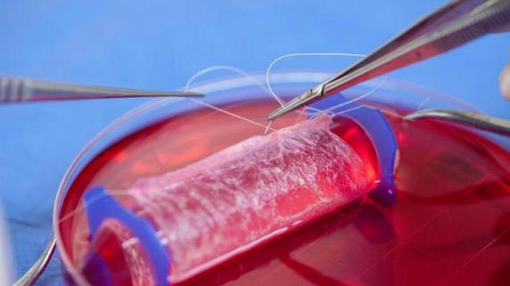 Momento del proceso de elaboración de la vagina artificial