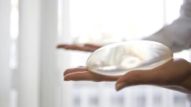 Imagen de un implante de pecho / EUROPA PRESS