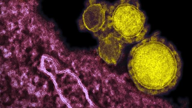 Imagen microscópica del coronavirus / EP