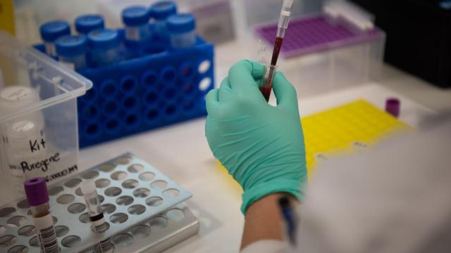 Investigadores en una foto de archivo realizando un estudio sobre tumores / HOSPITAL CLÍNIC