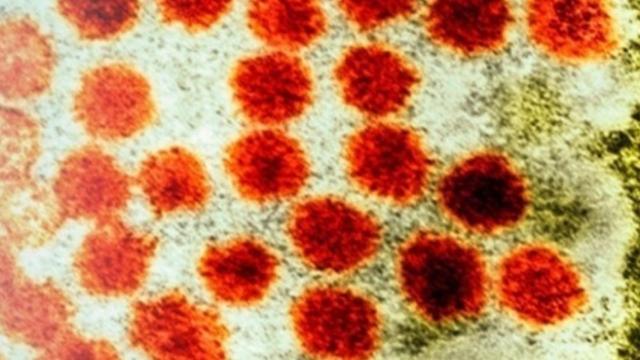 El virus de la hepatitis / EP