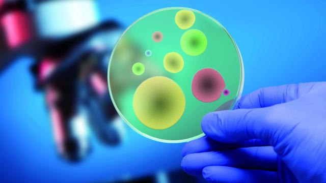 Una foto de archivo de enfermedades raras o lisosomales