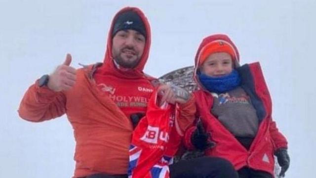 Albie Jr Thomas, el niño de cuatro años con el pie amputado, y su padre