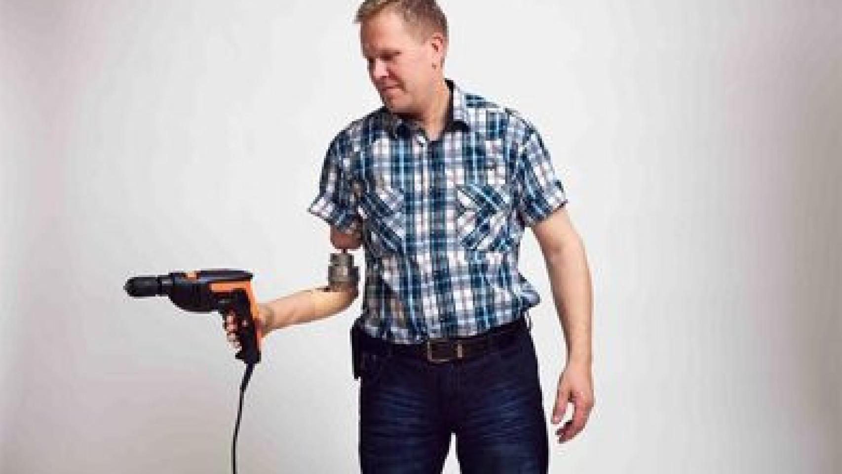 La prótesis de brazos biónicos permite al paciente volver a realizar actividades de la vida cotidiana