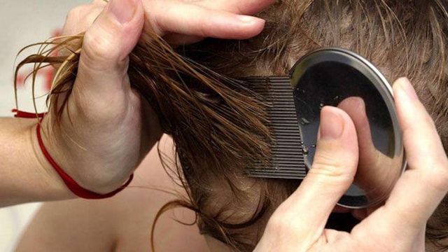 Una foto ilustrativa de un tratamiento para piojos