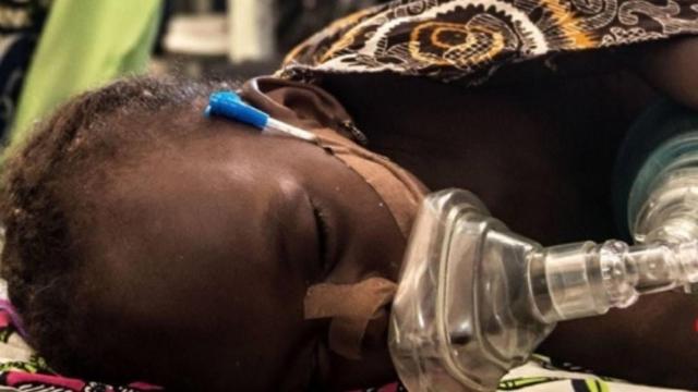 Niño que padece neumonía infantil / EUROPA PRESS