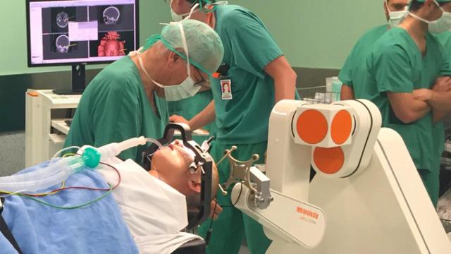 Una imagen del robot Renishaw, utilizado tanto en pacientes de epilepsia como de parkinson