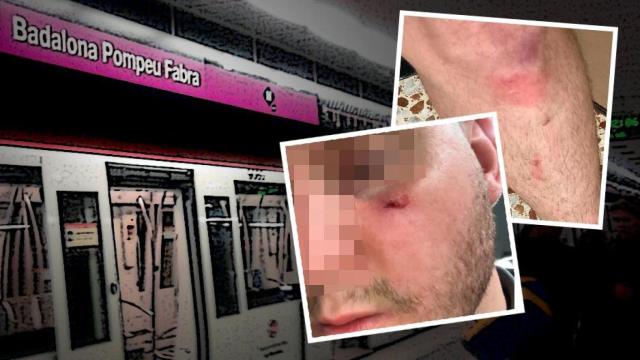 Uno de los vigilantes de seguridad agredidos en la parada de metro Pompeu Fabra de Badalona, Barcelona / CG