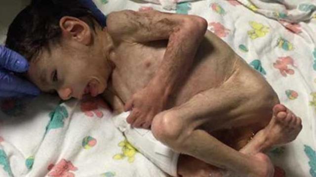 Ryan, el niño búlgaro antes de la adopción / CG