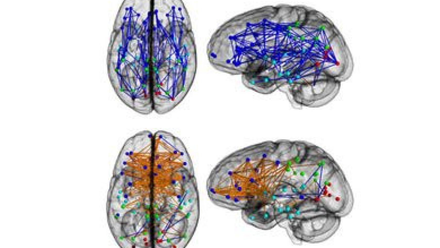 En la parte superior, el cerebro masculino; en la inferior, el femenino. En azul, las conexiones en un mismo hemisferio; en naranja, los circuitos entre hemisferios