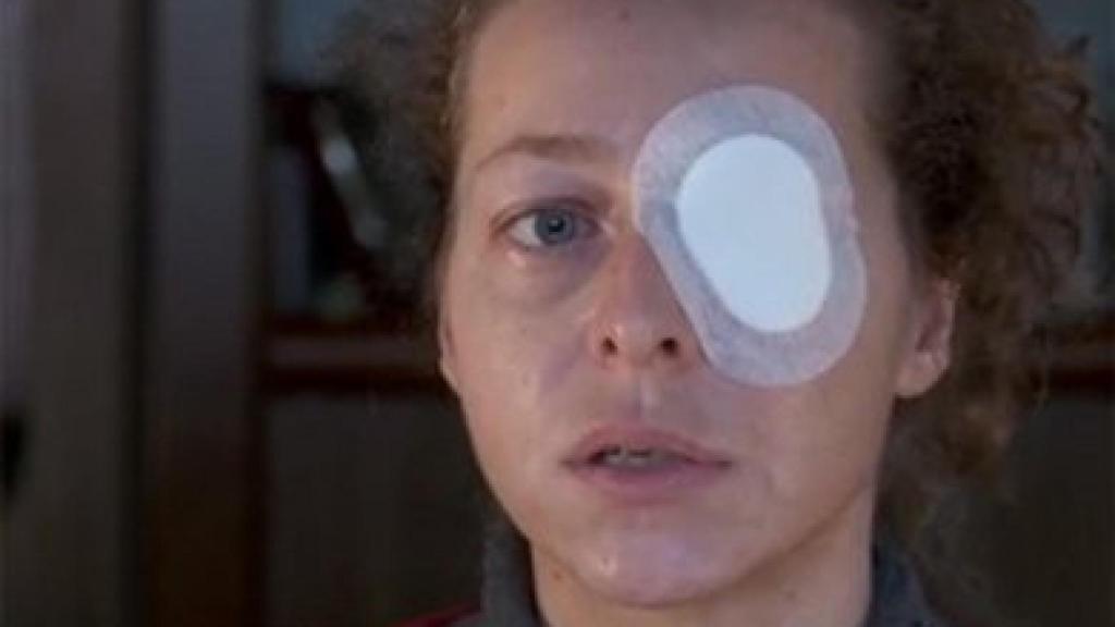 Esther Quintana, explicando su caso 15 días después de perder el ojo