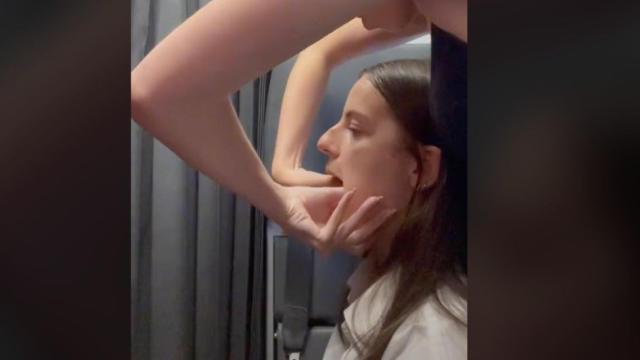 Bosteza y se disloca la mandíbula / TIKTOK