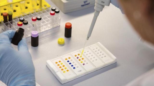 Detalle de un proyecto de biotecnología en un laboratorio / EFE