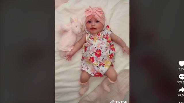 Ayla, la bebé con malformación bucal /TIKTOK