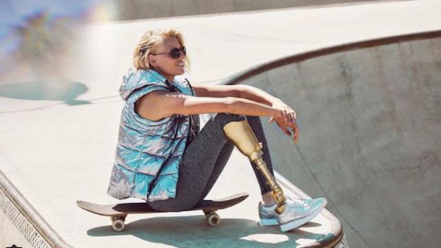 Una foto de archivo de la modelo californiana Lauren Wasser