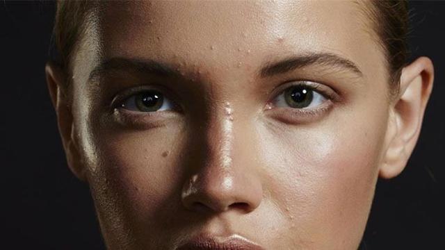 Cara de una joven con acné / EP