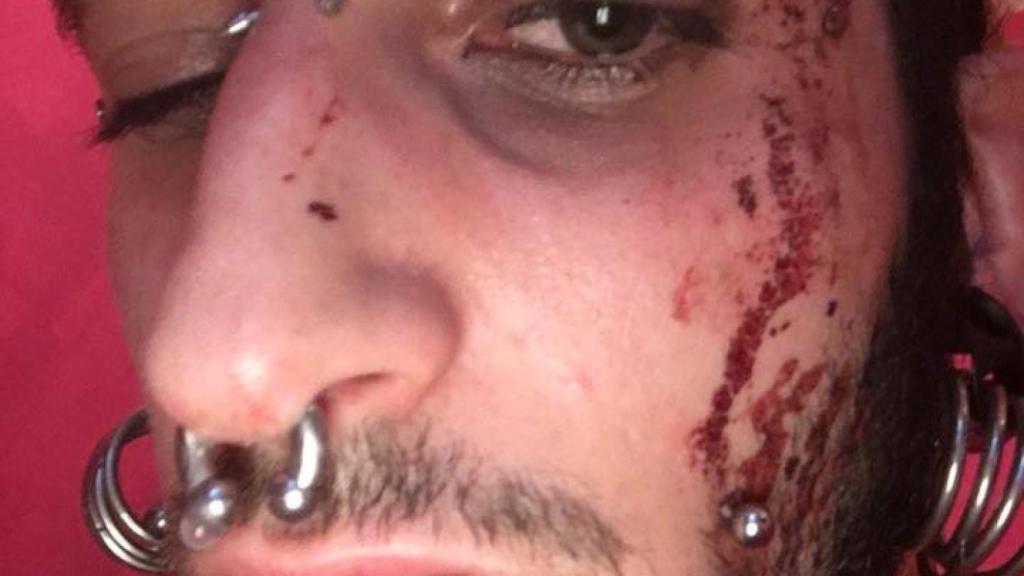 Cara de la víctima después de la agresión / @xavitallon