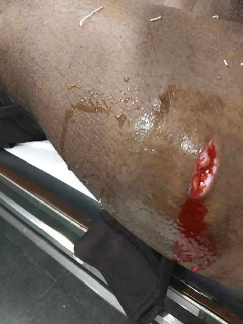 El vigilante recibió varias puñaladas en los brazos / Metropoli Abierta