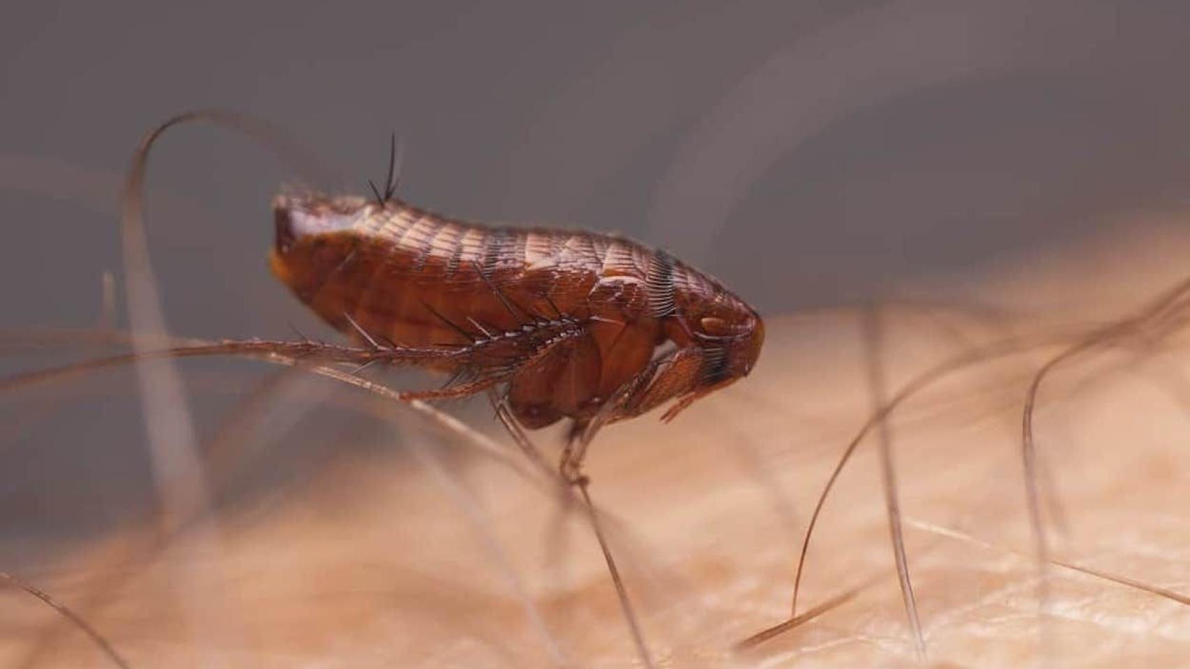 Una pulga picando a un ser humano / PIXABAY