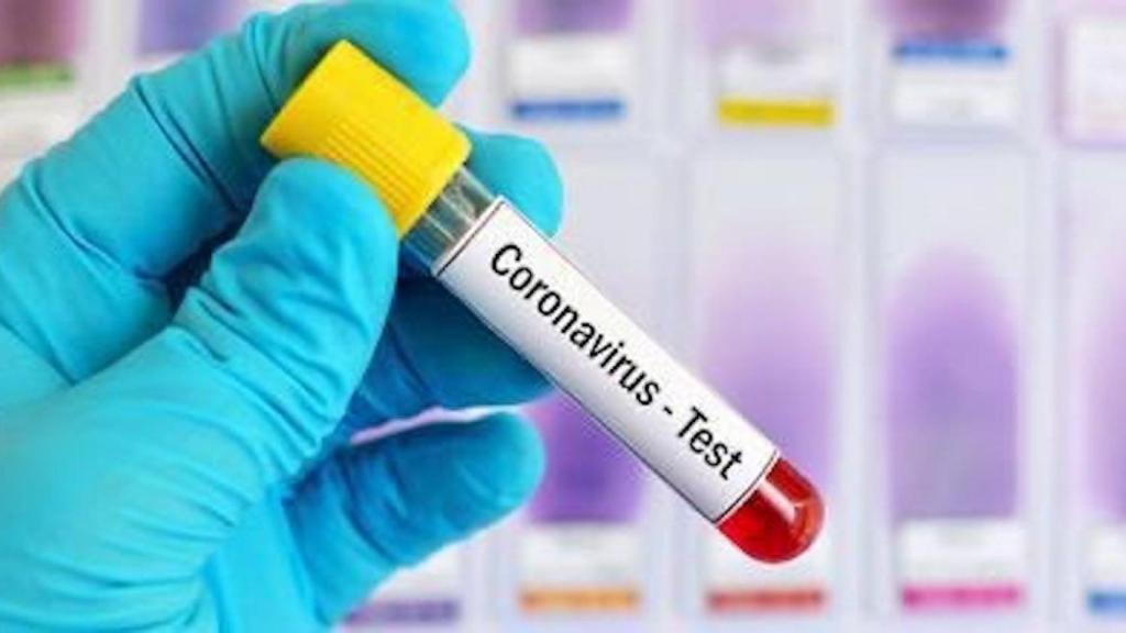 Imagen de archivo de un test PCR / TWITTER