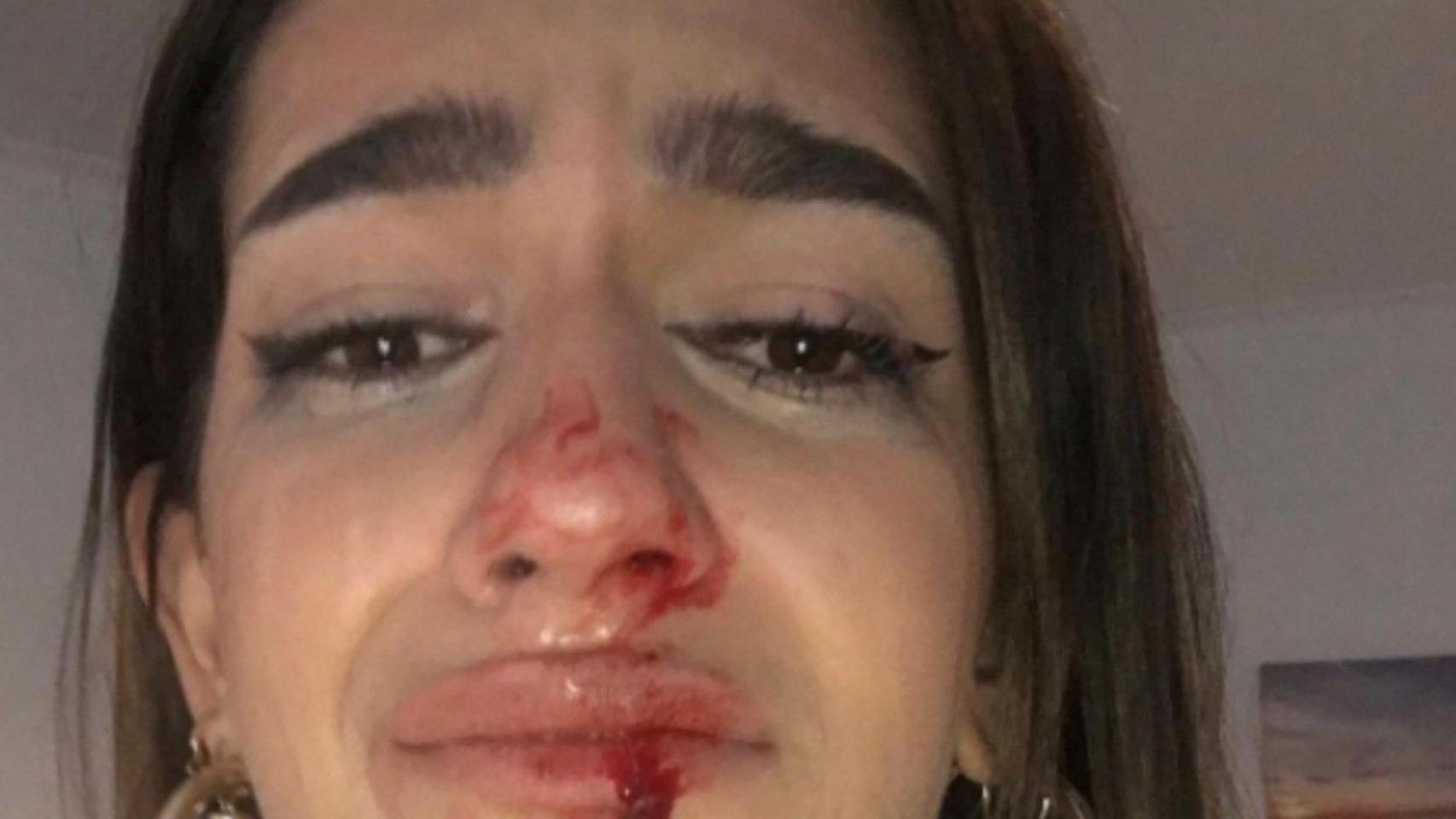 Eva Vildosola, la joven transexual agredida en Barcelona / @EVACASTT