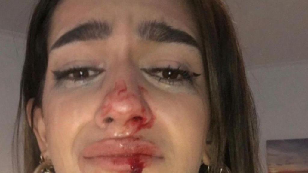 Eva Vildosola, la joven transexual agredida en Barcelona / @EVACASTT