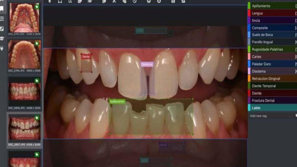 VDMHEALTH detecta problemas de salud con un simple escaneo a través de su cámara