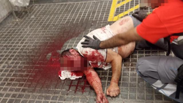 El personal de seguridad privada socorre al herido en una pelea a botellazos en Torre Baró