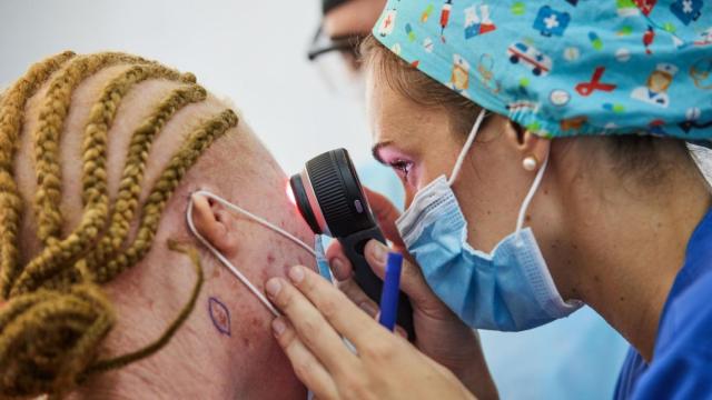 Una doctora revisa posibles lesiones de piel a extirpar con cirugía