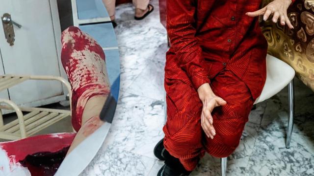 Las heridas de la víctima y su sobrina, denunciante desde Barcelona