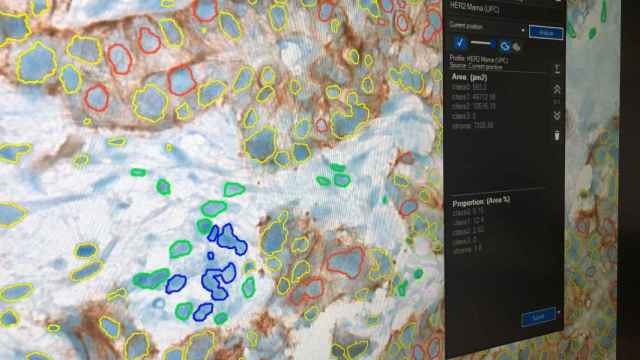Un investigador trabaja con la herramienta de inteligencia artificial en el Hospital Vall d'Hebron