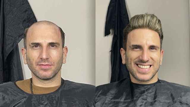 Prótesis capilar de Yqué!? Hair