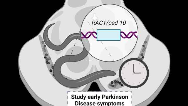 Gráfico del estudio para estudiar el Párkinson en un estadio precoz