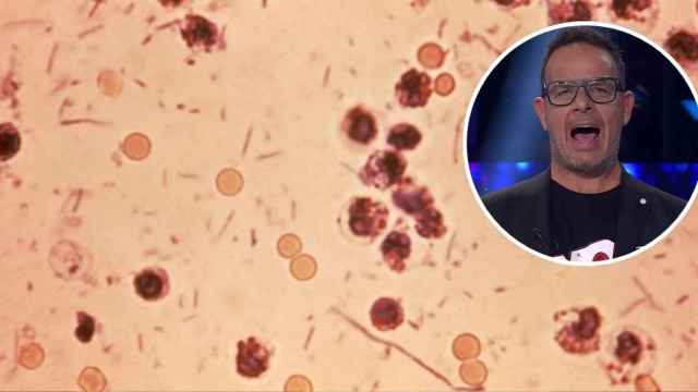 Creación con la bacteria Shigella y Àngel Llàcer