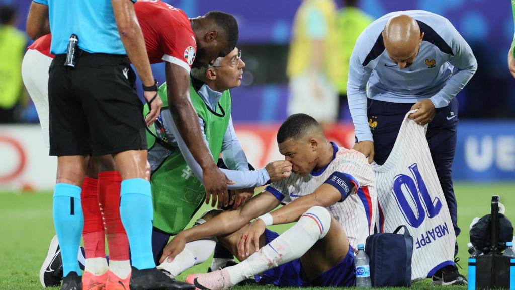 Los servicios médicos de la selección francesa tratan a Mbappé tras un golpe en la nariz