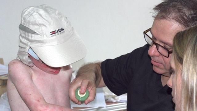 Proyecto de ayuda a las personas con albinismo de ISDIN