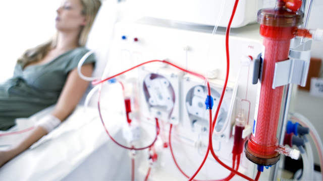 Imagen de archivo de un paciente de diálisis