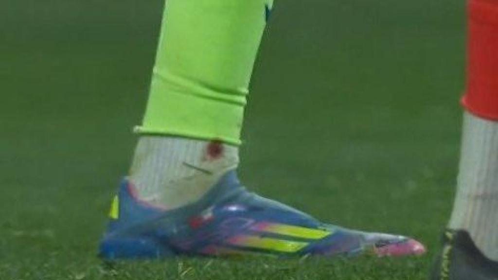 La mancha de sangre en la media de Lamine Yamal, tras el pisotón de Clément Lenglet