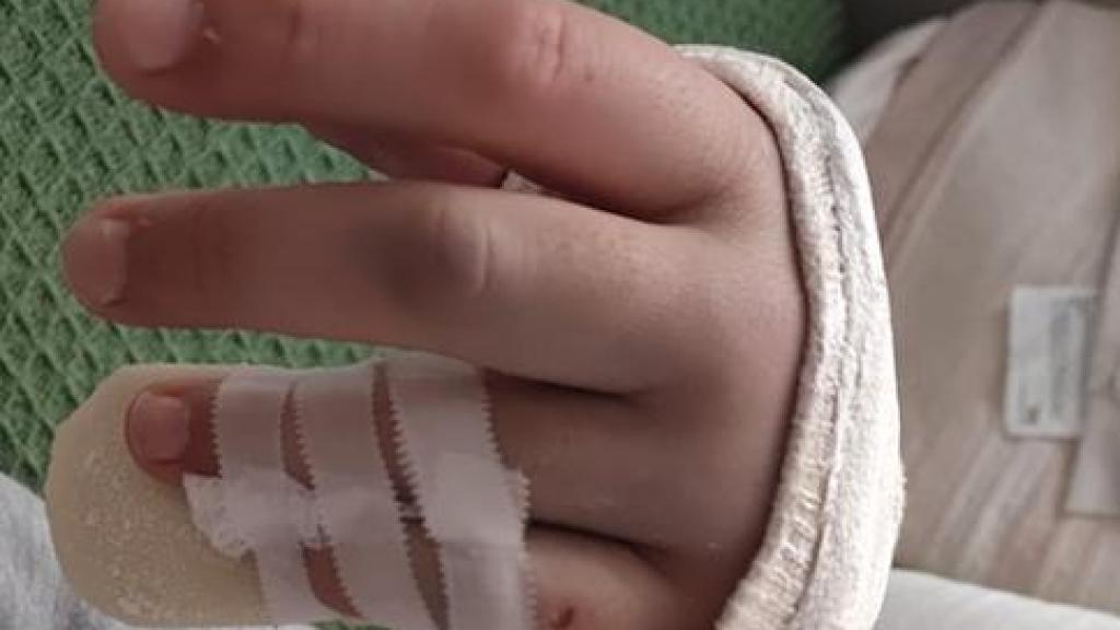 Imagen de las lesiones sufridas por un vigilante de Renfe en Cerdanyola