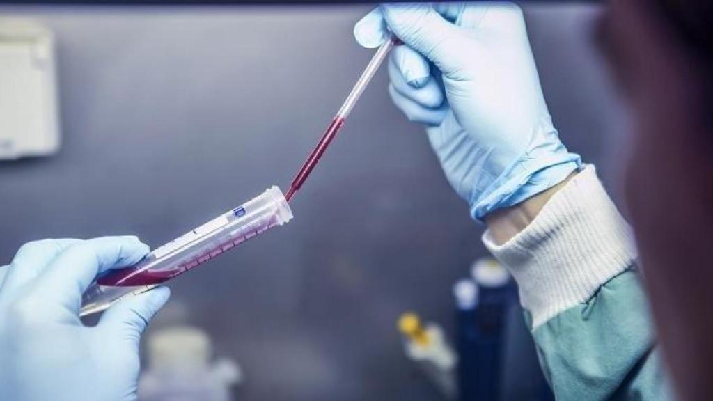 Un médico, analizando sangre para detectar la exposición reciente a la malaria 'recurrente'