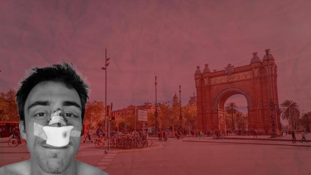 Santiago, el joven que recibió una paliza en el centro de Barcelona en el transcurso de un robo