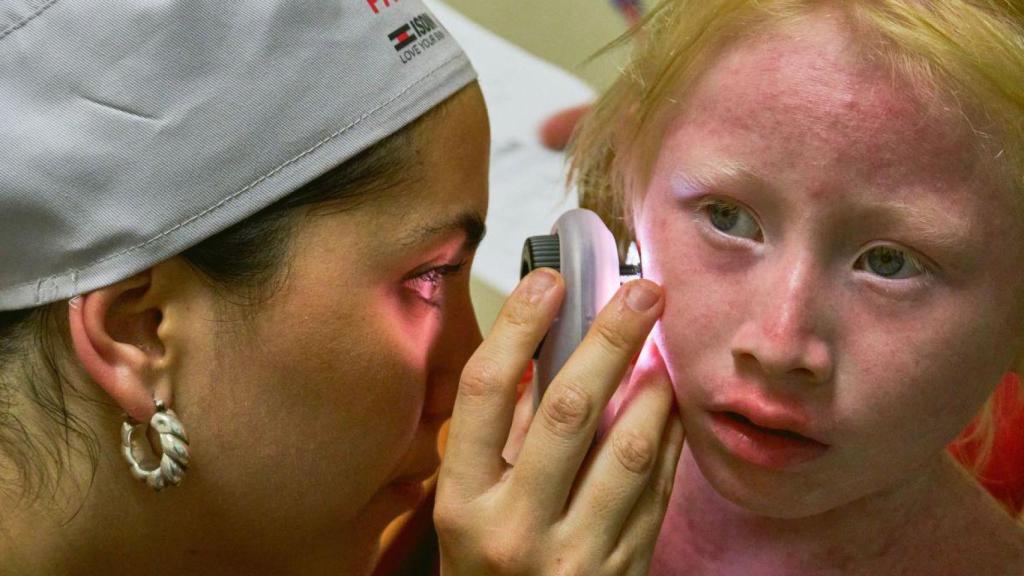 ISDIN atiende a más de cien personas con albinismo en Panamá para luchar contra el cáncer de piel