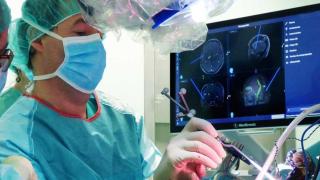 Un neuroncólogo durante una intervención