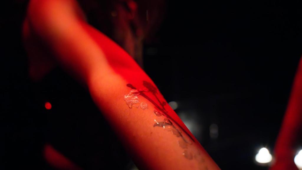 Cera ardiendo en la piel de una 'clubber' en Imperial