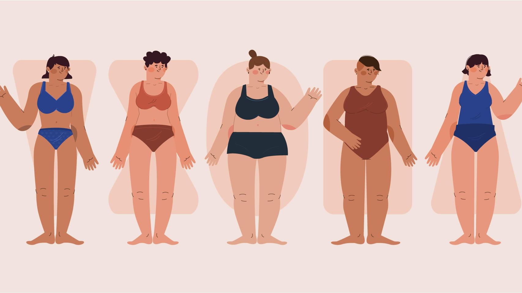 El lipedema es un trastorno genético que padecen algunas mujeres