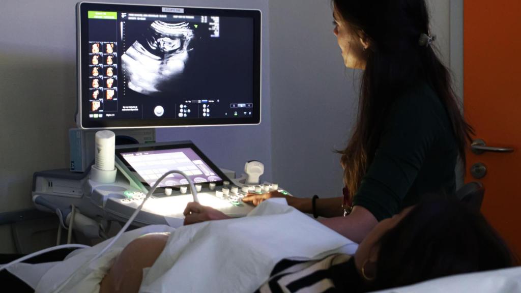 Imagen de una embarazada viendo cómo le hacen una ecografía