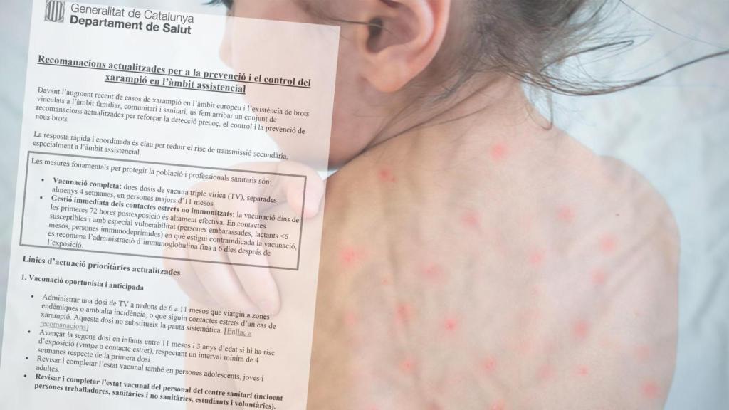 Circular de la Conselleria de Salud sobre el virus del sarampión.